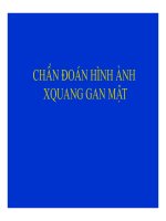 XQ gan-mat.pdf