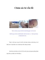 Tài liệu Chăm sóc bé rốn lồi docx