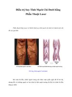 Tài liệu Giáo trình Điều trị Suy Tĩnh Mạch Chi Dưới bằng Phẫu Thuật Laser pptx
