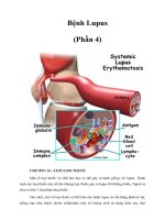 Tài liệu Bệnh Lupus (Phần 4) docx