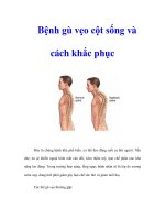 Tài liệu Bệnh gù vẹo cột sống và cách khắc phục doc