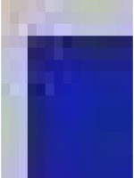 Điều trị chống huyết khối trong tai biến mạnh máu não