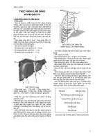 Tài liệu Thực hành lâm sàng khám gan to docx