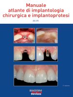 Kỹ thuật lâm sàng cắm ghép implant nha khoa