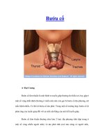 Tài liệu Bướu cổ pdf