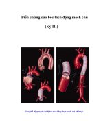 Tài liệu Biến chứng của bóc tách động mạch chủ (Kỳ III) pdf