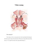 Tài liệu Viêm xoang pptx