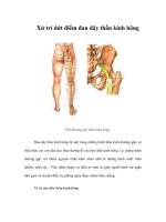 Tài liệu Xử trí dứt điểm đau dây thần kinh hông pptx