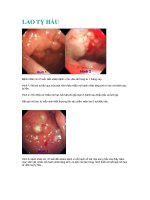 Tài liệu LAO TỴ HẦU doc