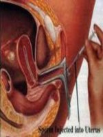 Tài liệu Giáo trình Đại cương viêm âm đạo pptx