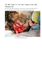 Tài liệu Giáo trình Chỉ Định Chụp CT scan hoặc X-quang trong Chấn Thương Sọ Não docx