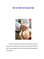 Tài liệu Xử trí khi trẻ bị sặc bột doc