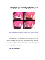 Tài liệu Thủ phạm gây viêm họng hạt tái phát docx