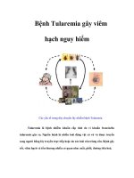 Tài liệu Bệnh Tularemia gây viêm hạch nguy hiểm docx