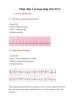 Tài liệu Nhận diện 1 số loạn nhịp trên ECG pdf