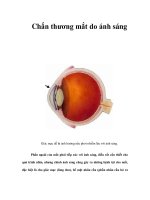 Tài liệu Chấn thương mắt do ánh sáng doc