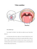 Tài liệu Viêm amiđan docx