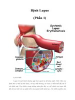 Tài liệu Bệnh Lupus (Phần 1) pptx