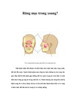 Tài liệu Răng mọc trong xoang? ppt