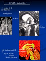 Tài liệu MRI Kỹ thuật chụp sọ docx