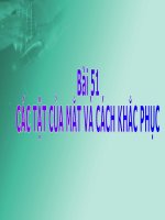 cac tat cua mat - cach sua