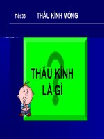 Thau kinh mong