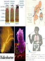 Vệ sinh ăn uống