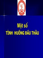21 tình huống điển hình trong đấu thầu 