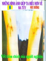 Tài liệu Hội thi Tuyên truyền phòng chống ma túy
