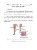 Giáo Trình Phẫu Thuật Tuốt Bỏ Tĩnh Mạch Trướng Trong Điều Trị Suy Tĩnh Mạch Chi Dưới