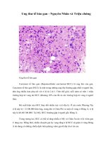 Giáo trình Ung thư tế bào gan - Nguyên Nhân và Triệu chứng