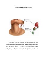 Viêm amidal và cách xử lý