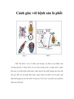Cảnh giác với bệnh sán lá phổi