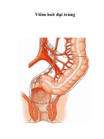 Viêm loét đại tràng