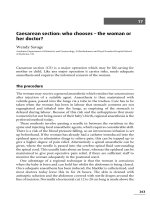 Caesarean section - who chooses – the woman or her doctor