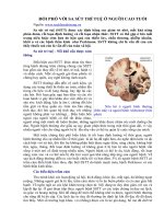 ĐỐI PHÓ VỚI SA SÚT TRÍ TUỆ Ở NGƯỜI CAO TUỔI