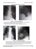 Ung thư phổi và u trung thất_Phần 3