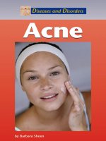 Tài liệu Diseases and Disorders Acne docx