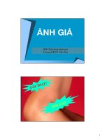 Tài liệu Ảnh giả siêu âm ppt