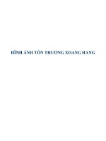 Tài liệu HÌNH ẢNH TỔN THƯƠNG XOANG HANG ppt