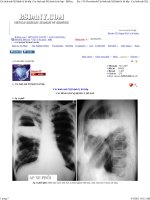 HÌnh ảnh x quang bệnh lý hô hấp