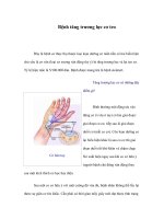 Tài liệu Bệnh tăng trương lực cơ teo doc