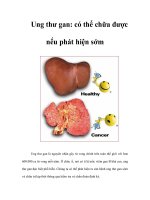 Tài liệu Ung thư gan: có thể chữa được nếu phát hiện sớm ppt