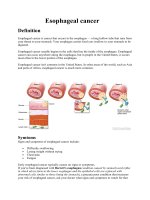 Tài liệu Esophagus cancer doc
