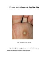 Tài liệu Phương pháp trị mụn cóc lòng bàn chân pdf