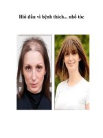 Tài liệu Hói đầu vì bệnh thích... nhổ tóc docx