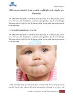 Hiện tượng nôn trớ của trẻ sơ sinh và cách xử lý