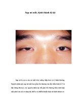 Tài liệu Sụp mi mắt, bệnh thành dị tật doc