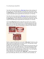 Vì sao niềng răng ngày càng phổ biến 