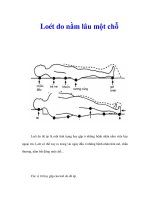 Tài liệu Loét do nằm lâu một chỗ pdf